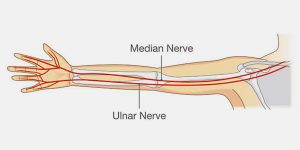 Compressão do Nervo Ulnar